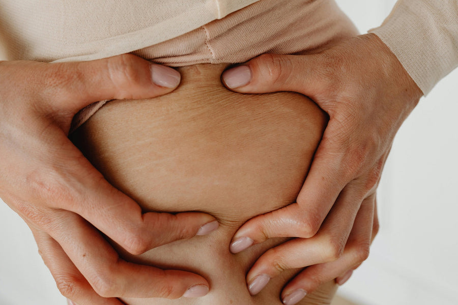 Integratore per la cellulite: può davvero aiutarti?