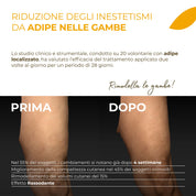 Schlankmachende und entwässernde Beincreme