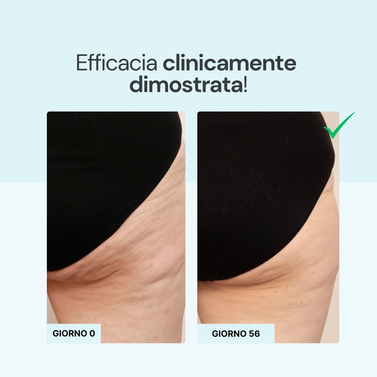 Cellulite-Creme mit frischem Effekt