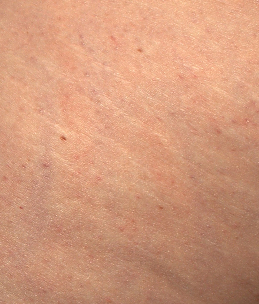 Prima