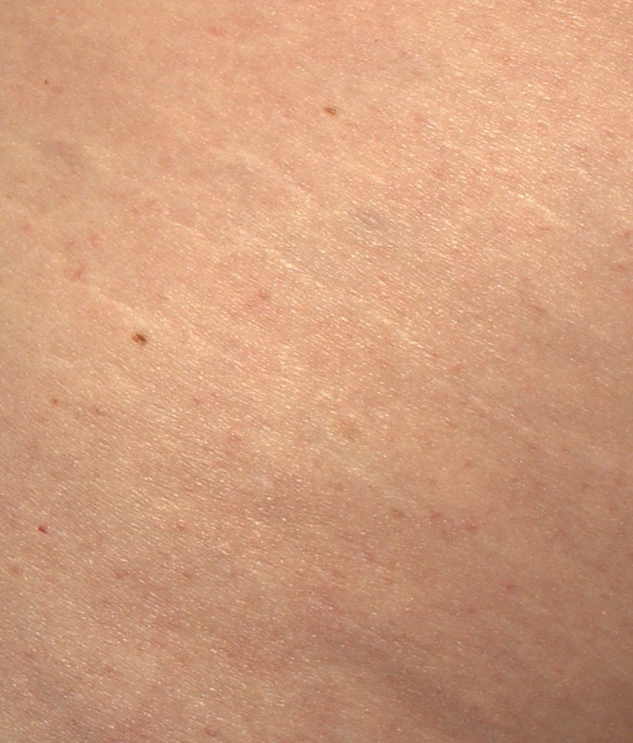 Dopo